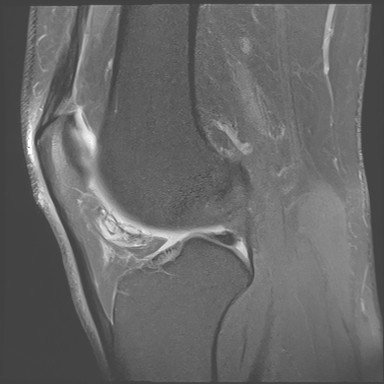 Figure 3 for case Orthovisc injections